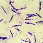 Leishmania